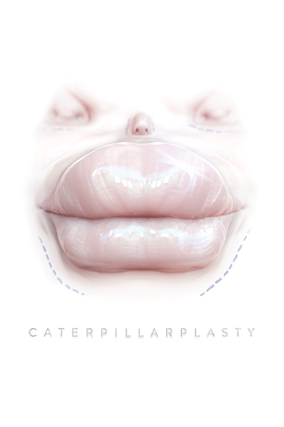 Caterpillarplasty on FREECABLE TV
