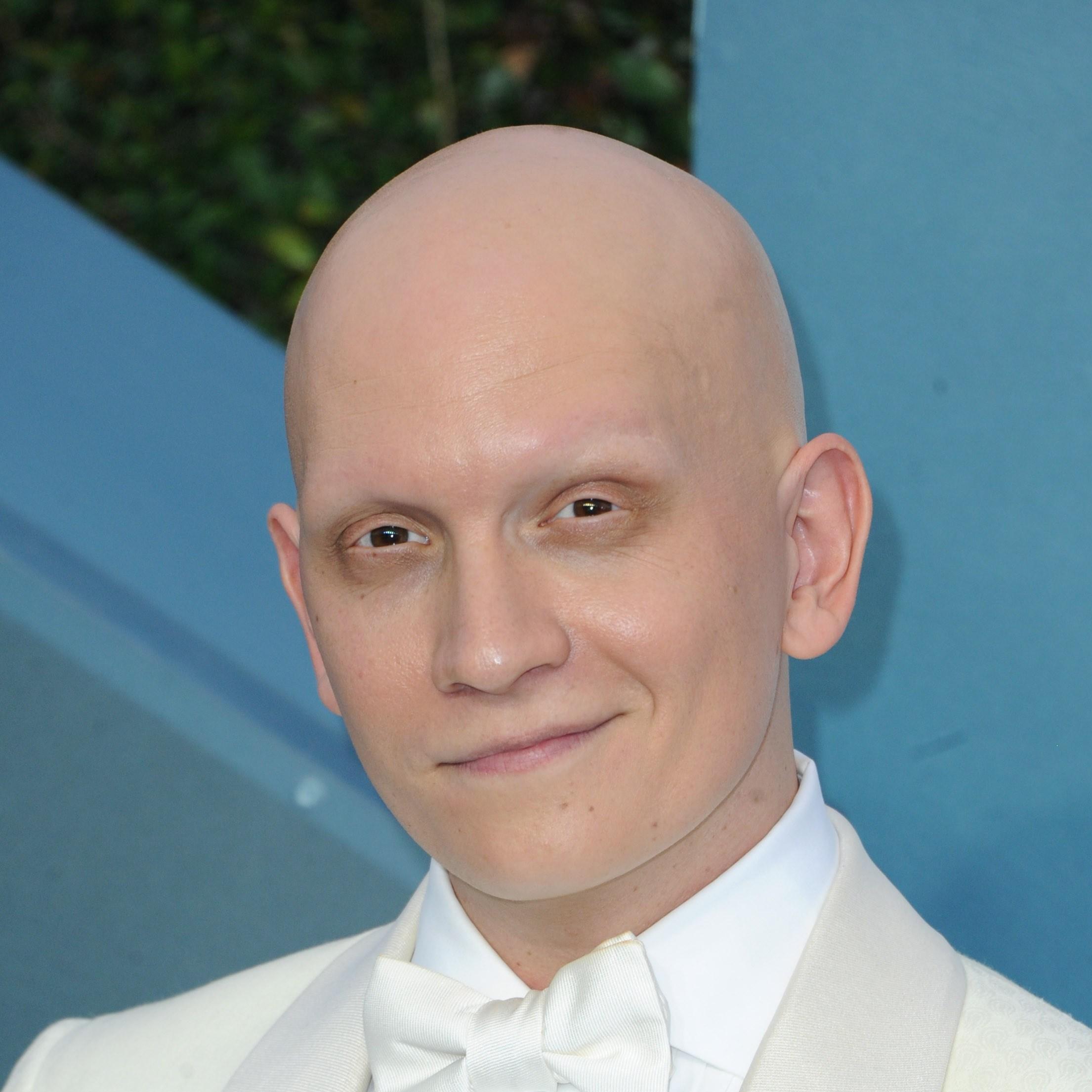 Anthony Carrigan